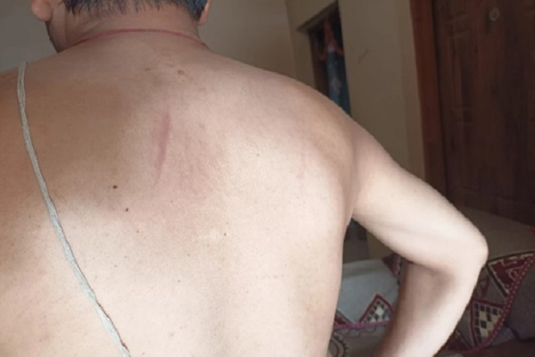 छत्तीसगढ़ में प्रभारी तहसीलदार के साथ पुलिस ने की मारपीट