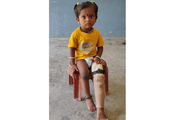 जयपुर पैर लगाकर खड़ा हुआ ढाई साल का दिसान