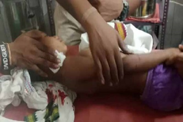 घर के सामने खेल रहे मासूम पर तेंदुए ने किया हमला