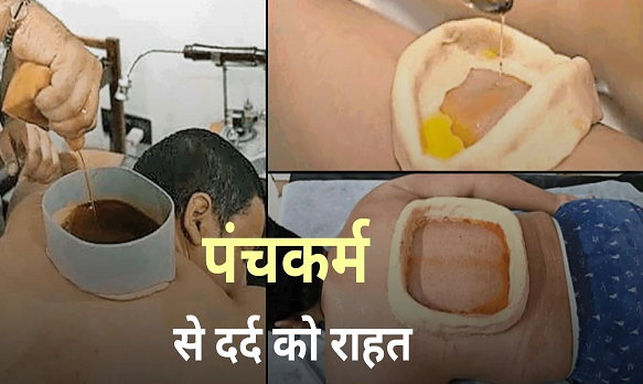 पंचकर्म से मिल रही पुराने दर्द से राहत, गठिया, त्वचा रोग, मोटापा, मधुमेह के लिए रामबाण