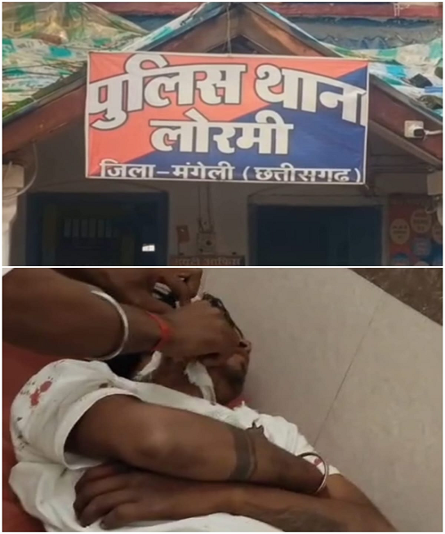 लोरमी मुख्य मार्ग में फिल्मी अंदाज में युवकों ने किया किया हमला, युवक को आयी गम्भीर चोट बिलासपुर रिफर