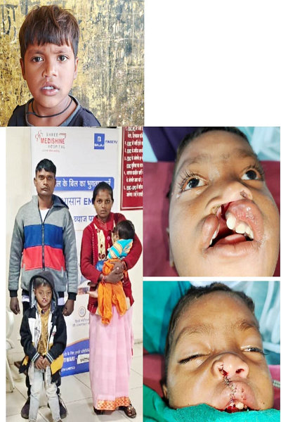 बस्तर के वनांचल से खिलखिलाती मुस्कान की नई इबारत लिख रहा नन्हा विक्रम