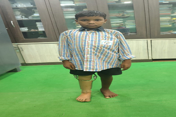 10 साल के कमलेश को मिला कृत्रिम पैर, अब मंजिल की ओर बढ़ेंगे कदम