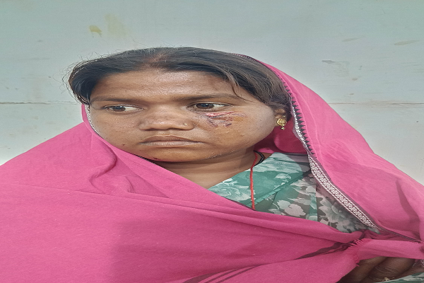  सुबह करीब 7:30 बजे हुई घटना, प्राथमिक उपचार के बाद अम्लीपदर से जिला चिकित्सालय भेजा गया; दोनों का इलाज जारी