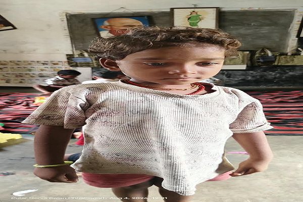  सेवा संकल्प अभियान : सेवा संकल्प से कुपोषण पर जीत, 16 सप्ताह में मिनाक्षी ने पाई सामान्य पोषण स्थिति