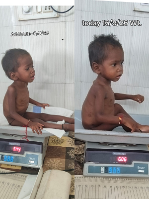  विशेष लेख : सेवा की कहानी : पोषण पुनर्वास केंद्र से लौट रही बच्चों के चेहरे की मुस्कान