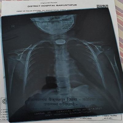 बच्चों को सिक्का, पिन, सुई, कांच, छोटी गिट्टी या छोटी वस्तुओं से दूर रखें : डॉ. प्रशांत सिंह