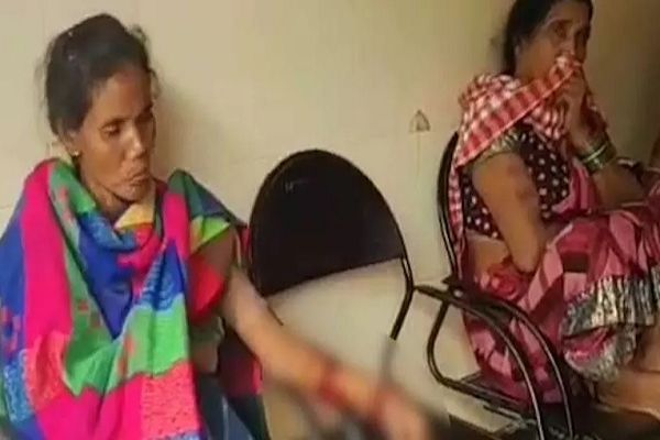 बिडोरा में भालुओं के हमले से तीन लोग घायल, मेडिकल कॉलेज रेफर