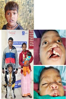 बस्तर के वनांचल से खिलखिलाती मुस्कान की नई इबारत लिख रहा नन्हा विक्रम