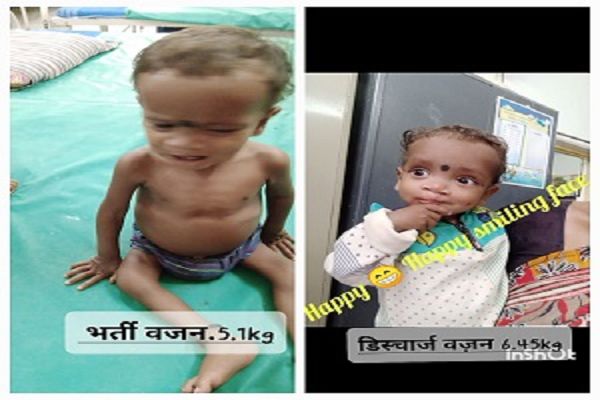 गरियाबंद पोषण पुनर्वास केंद्र ने गंभीर कुपोषित बच्चे ओमेश को स्वस्थ कर भेजा घर