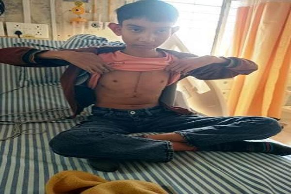 चिरायु योजना ने तेजेश्वर के दिल की बीमारी पहचानी, सफल सर्जरी से लौटी मुस्कान