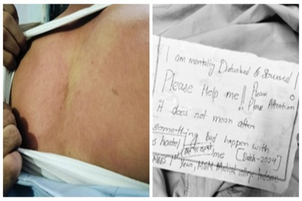 मेडिकल कॉलेज में रैगिंग: जूनियर छात्र ने बयां किया दर्द, कहा- रावण की लंका जैसा है हॉस्टल, नशा उतरने तक मारपीट करते हैं सीनियर्स  