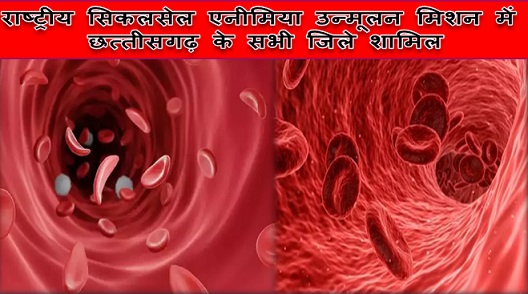 राष्ट्रीय सिकलसेल एनीमिया उन्मूलन मिशन में छत्तीसगढ़ के सभी जिले शामिल